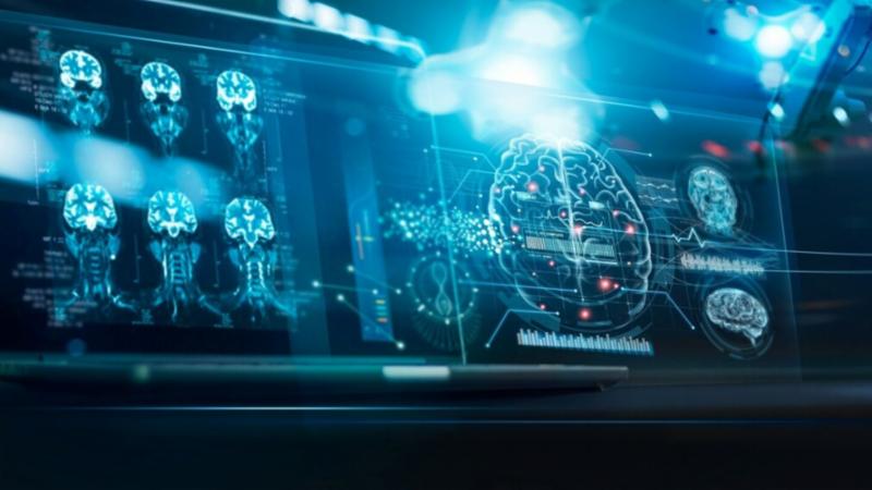 Escaneo de la actividad del cerebro durante el estudio